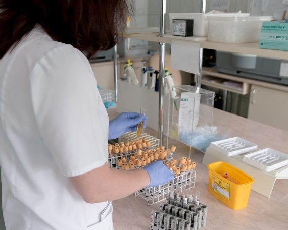 lab urine test
